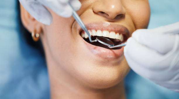 Emergency Gum Pain Relief in SC