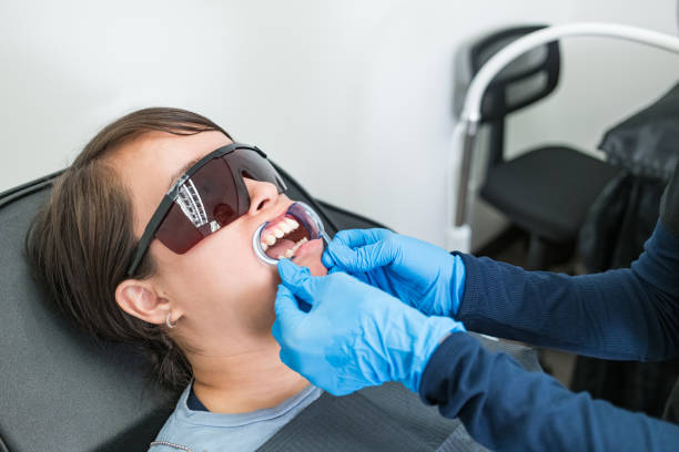 Teeth Whitening in SC