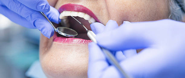 Best Knocked-Out Tooth Emergency  in Beech Island, SC
